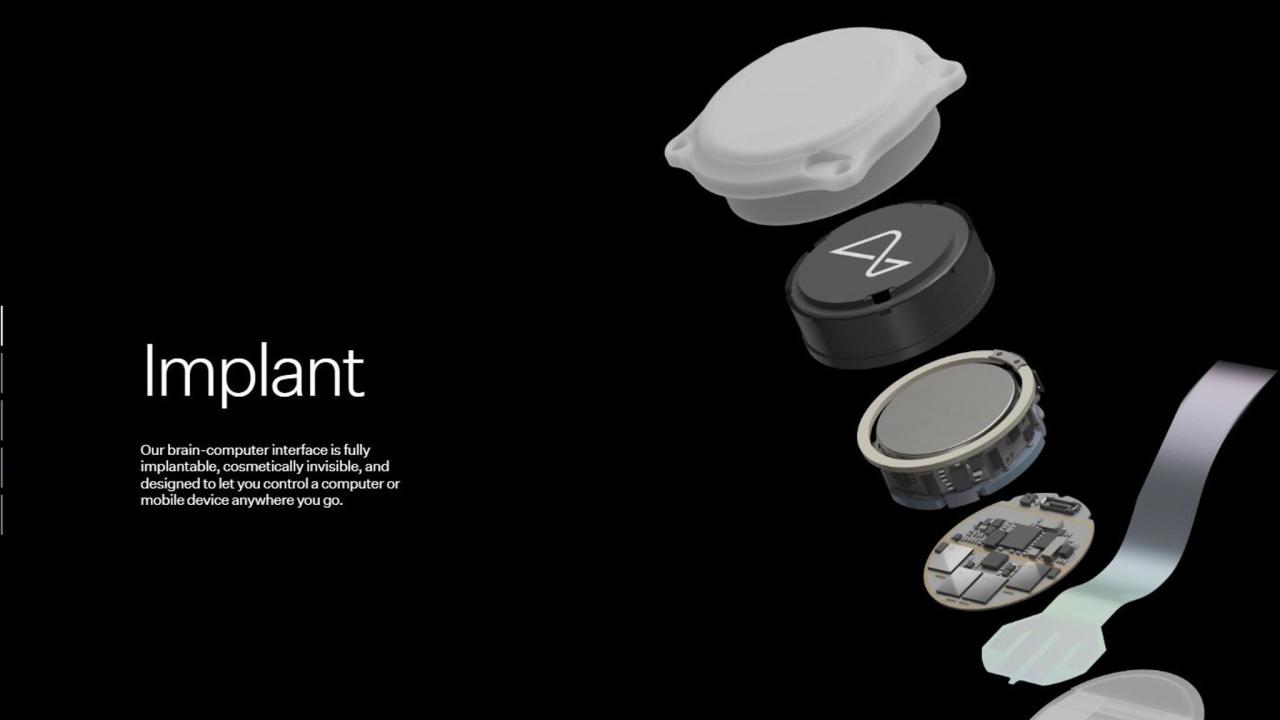 Elon musk neuralink brain implant transportation department investigation contaminated