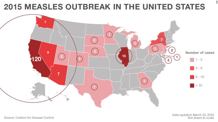 Measles outbreak affected spreads dc washingtonpost Measles outbreak affected spreads dc washingtonpost