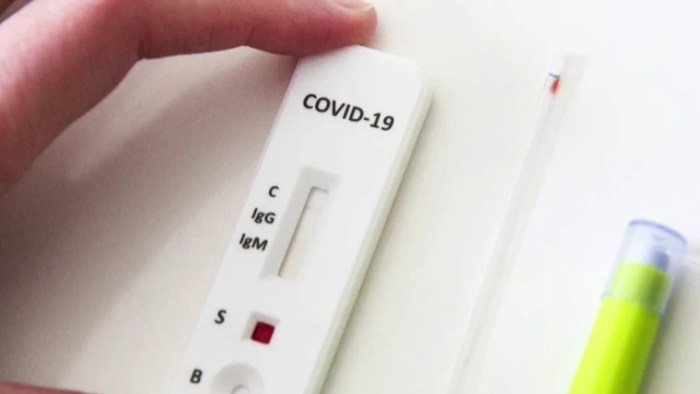 Covid 19 antigen tests states not reporting results