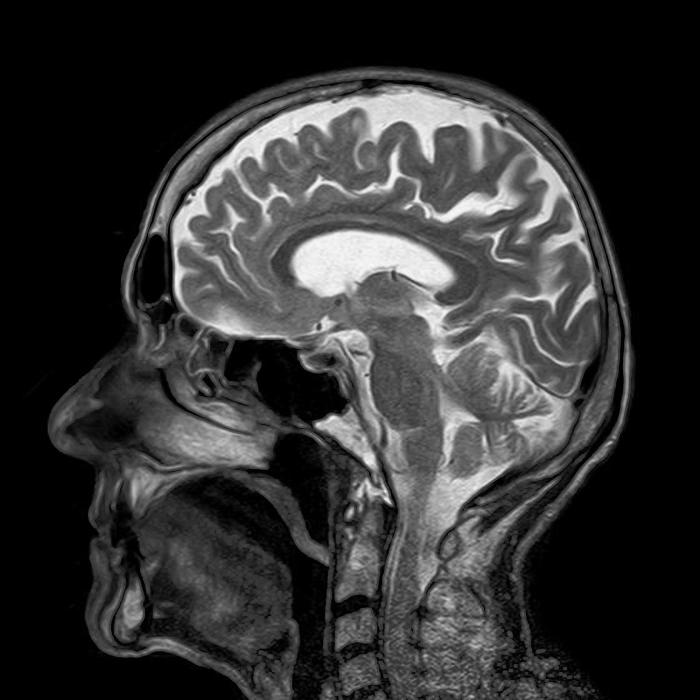 Mri faster thanks facebook nyu effort scans ai their make thehealthsite resonance magnetic Mri faster thanks facebook nyu effort scans ai their make thehealthsite resonance magnetic